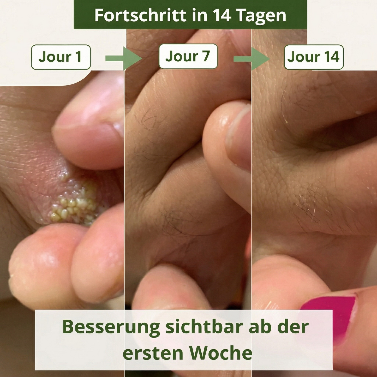 Lyvona Anti-Pilz-Seife